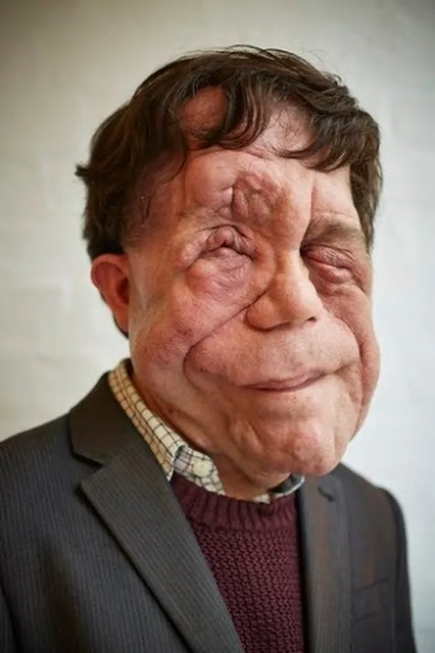 Adam Pearson fotoğrafı