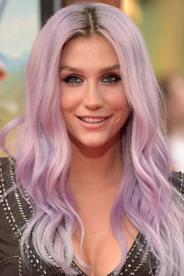 Kesha fotoğrafı